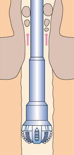 Borestreng i en brønn der formasjonen har reagert med væskene som brukes i borehullet. Det har medført at formasjonen sveller inn i brønnen og lager mindre hulldiameter over borekronen. Illustrasjon.