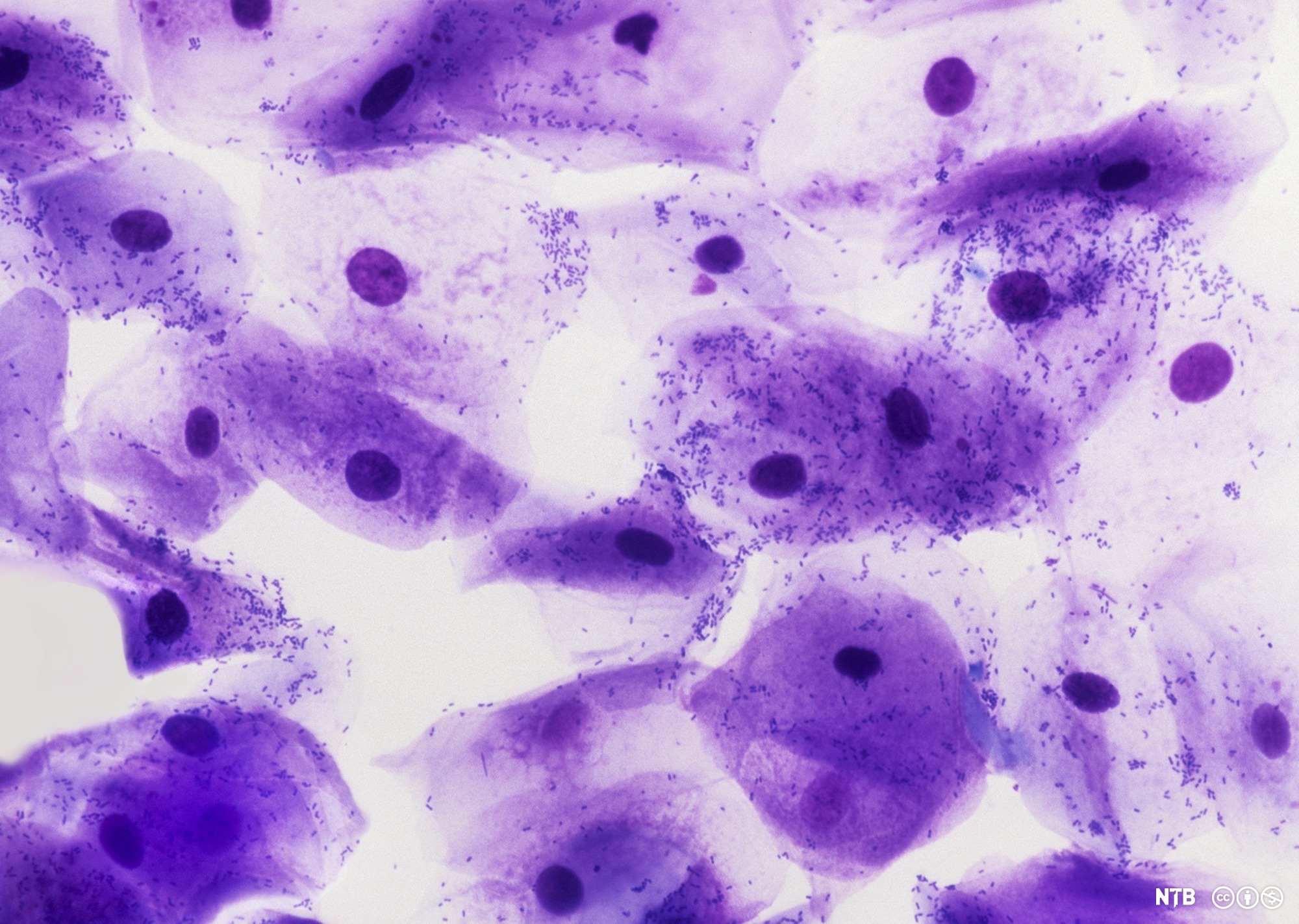 Flere celler med tydelig farget cellekjerne, sammen med bitte små prikker som er bakterier. Mikroskopfoto.