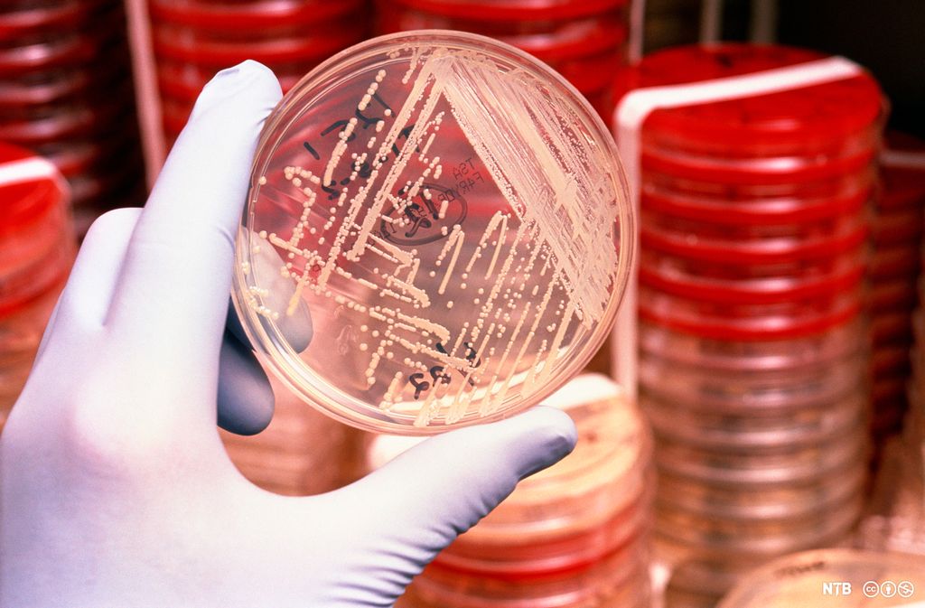 Ei hånd som holder fram ei rund petriskål med dyrkede bakterier. Foto. 