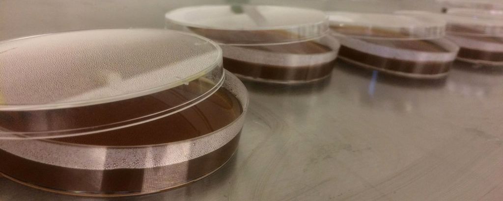 Petriskåler med agar. Foto.