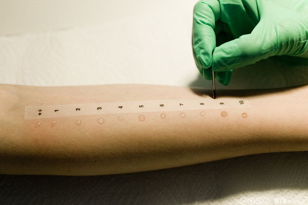 Ein arm med ein strimmel med tal frå 1 til 10 og ein blank væskedrope på huda ved sida av kvart tal. Ei hand med hanske skraper i huda ved sida av 9-talet. Foto.