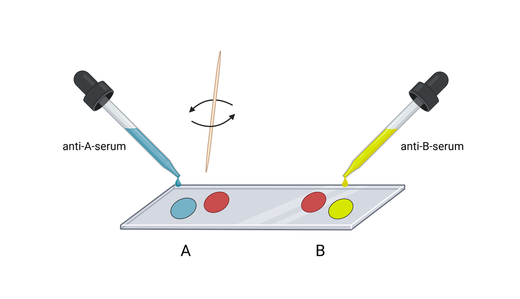 Glassplate med bloddråpe og anti-A-serum på den ene halvdelen, og bloddråpe og anti-B-serum på den andre halvdelen. Illustrasjon.