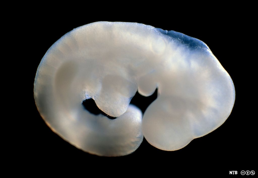 Museembryo. Foto. 