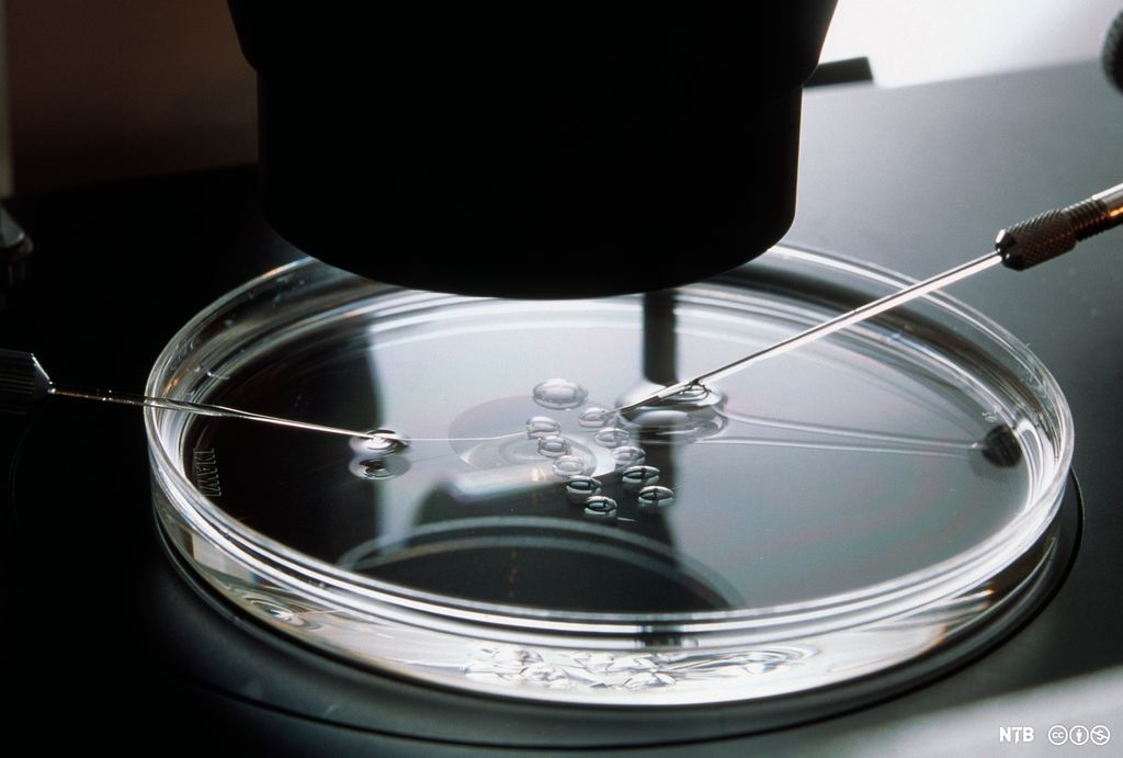 Cellekjernen i en eggcelle fjernes i ei petriskål under mikroskopet. Foto.