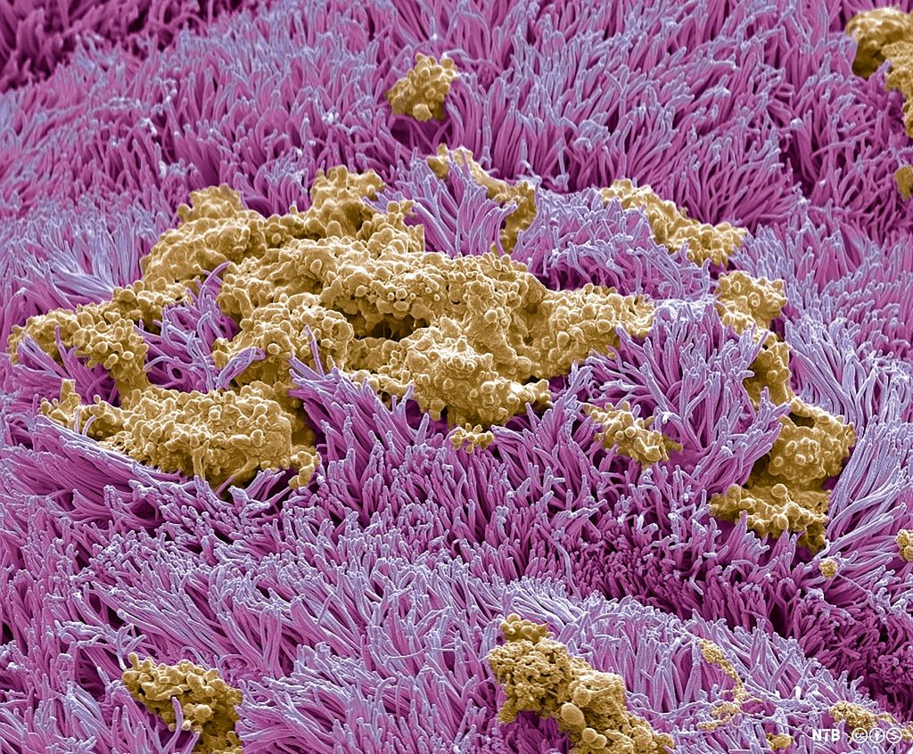 Slim og flimmerhår i luftrøret. Mikroskopfoto.