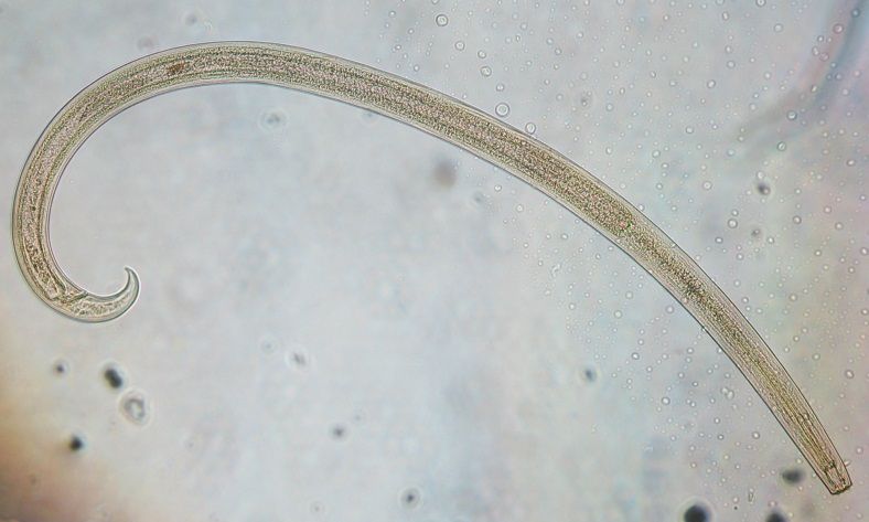 Mikroskopbilde av en gjennomsiktig orm med en spiss ende og en tverr ende. Foto.