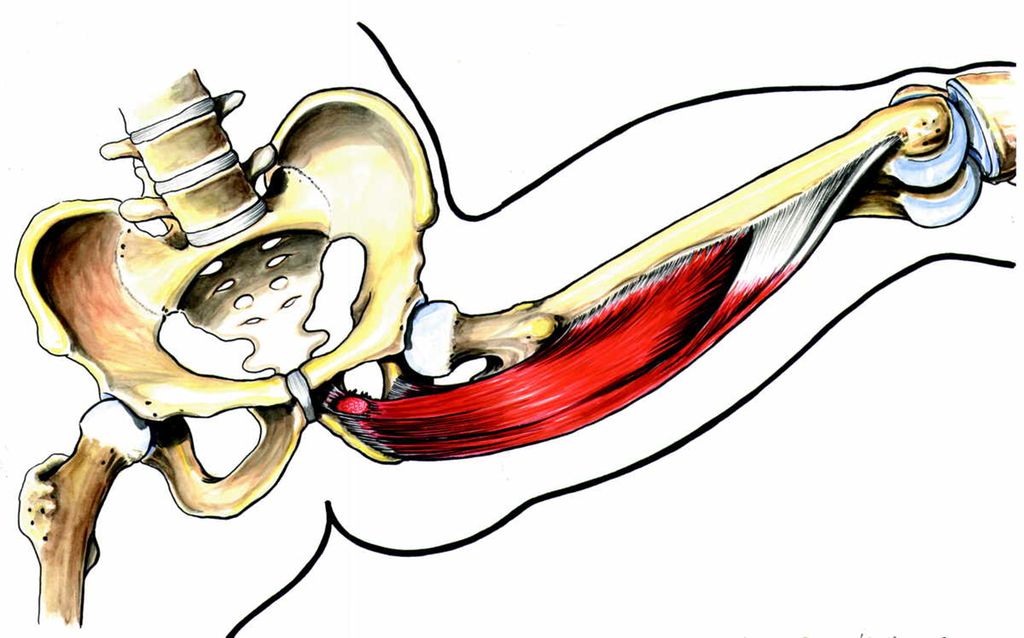 Illustrasjon av skjelett og lårmuskel med strekk i lysken