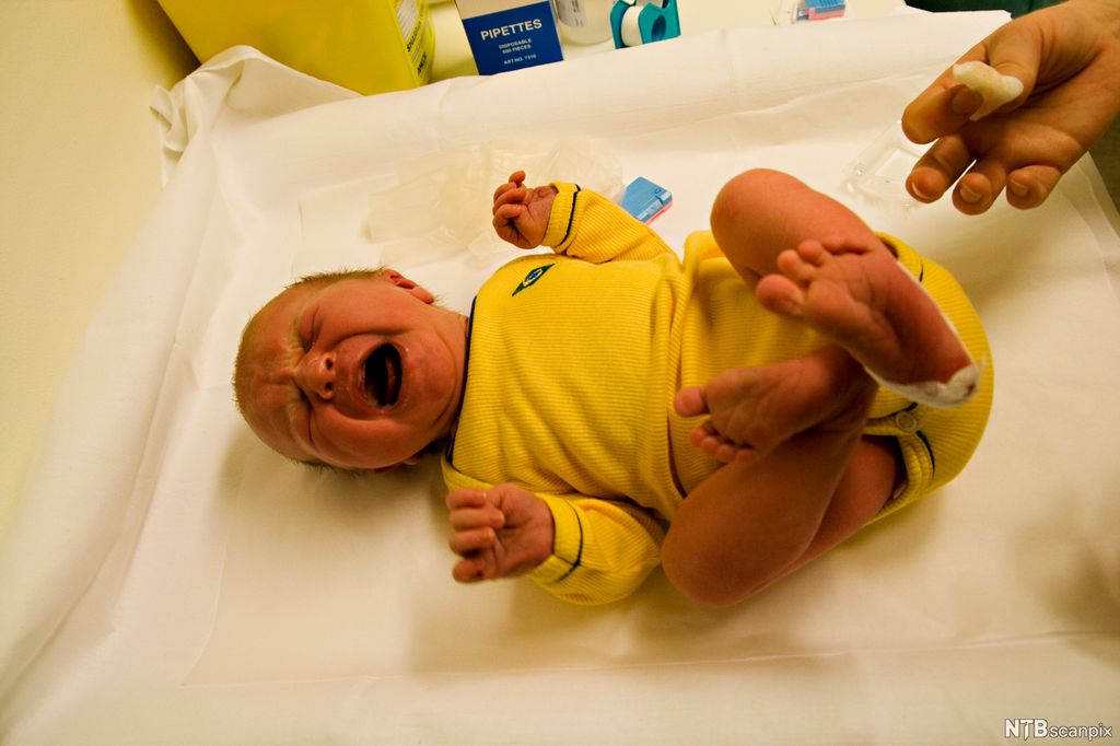 Baby i gul body blir tatt blodprøve av og hylskriker. Foto.
