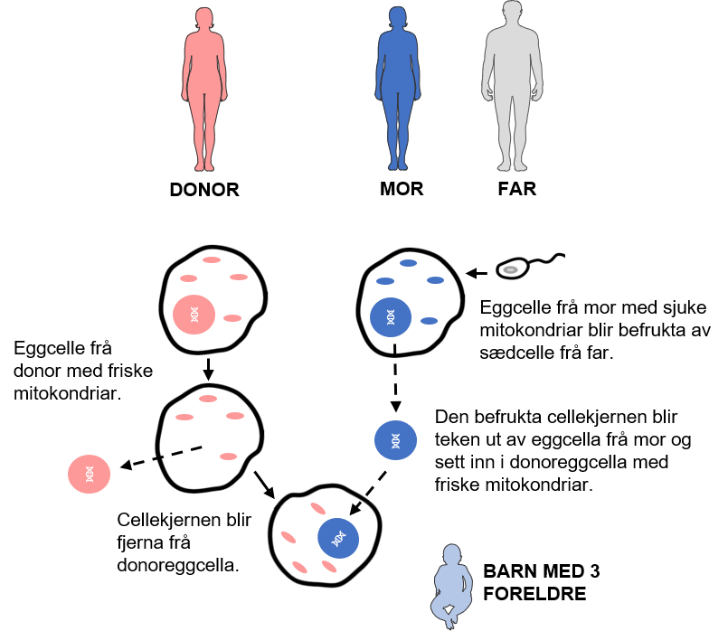 Donor av eggcelle med friske mitokondriar der cellekjernen blir teken ut, er markert med raudt. Mor med eggcelle med sjuke mitokondriar er markert med blått. Far med sædcelle er markert med grått. Resultatet blir ei donert eggcelle med friske raude mitokondriar som blir tilført ein blå befrukta cellekjerne frå mor. Illustrasjon av mitokondriedonasjon. 