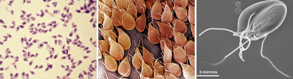 Tre bilder satt sammen til en kollasj. Det første bildet viser mange dråpeformede organismer med hale. Det andre bildet forstørrer disse små organismene og viser en tydeligere kroppsfasong med fire trådliknende utvekster. Det siste bildet er forstørret så mye at det bare viser én organisme. Mikroskopfoto. 