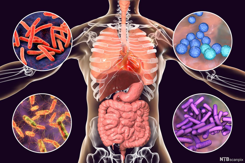 Overkropp illustrert som åpen, slik at skjelett og organer kommer til syne. Rundt kroppen er det fire sirkler som viser fram formen til noen vanlige bakterietyper: runde kokker og avlange staver med og uten flagell. Illustrasjon.