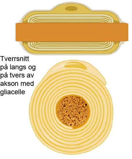 Illustrasjon der gliacellen omslutter nervetråden flere ganger og ligger i flere lag