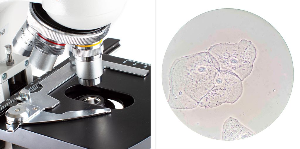 Bildekollasj som viser et mikroskop og et mikroskopbilde av en epitelcelle. Foto. 