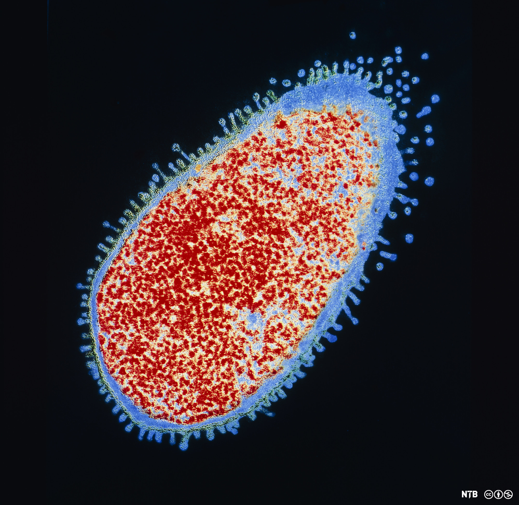 En bakterie som har en oval form med flere mindre utløpere langs kanten. Mikroskopfoto. 