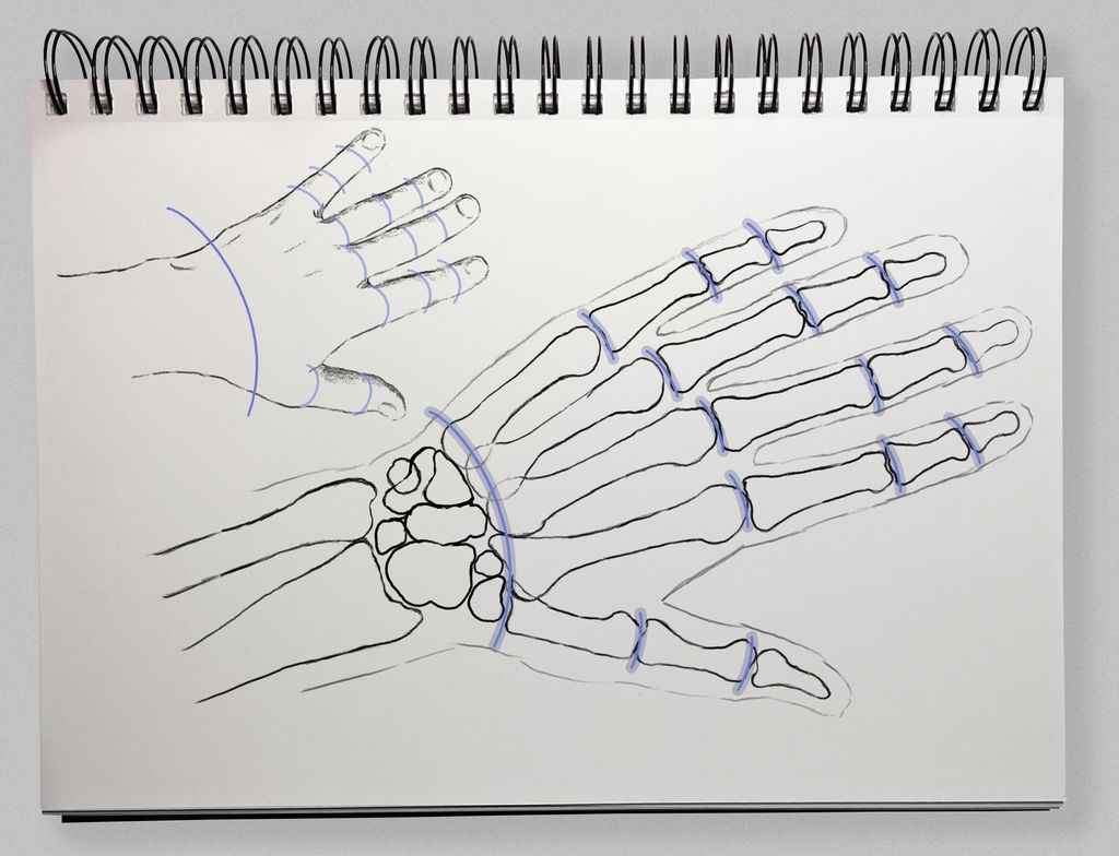Teikning av to hender. Knoklane er teikna inn i den eine. Illustrasjon.