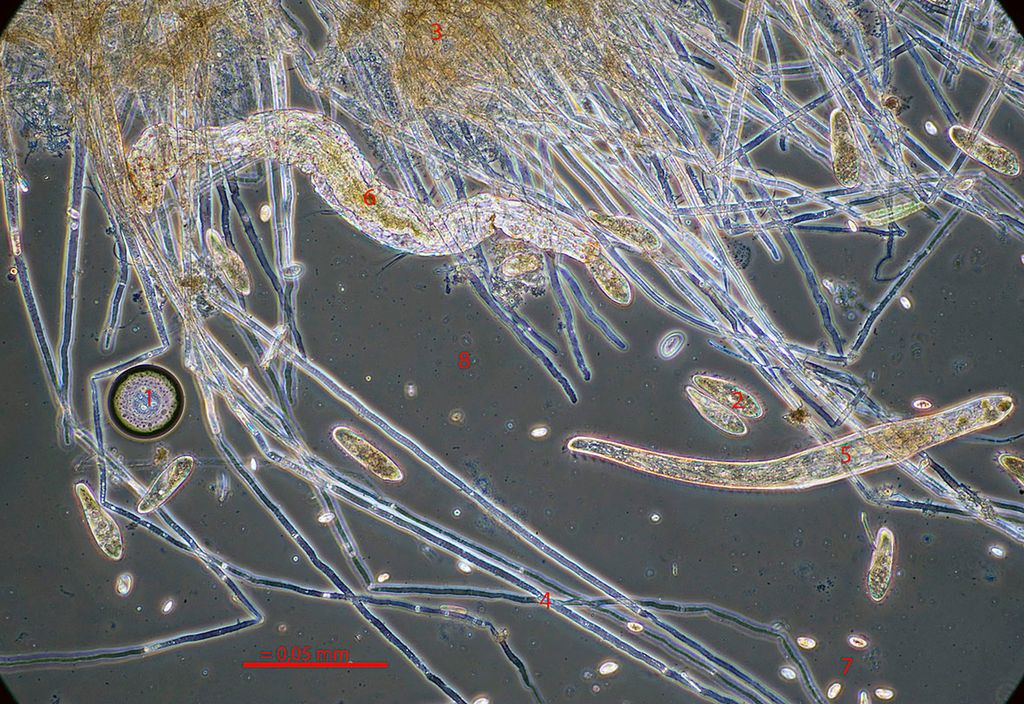 Mikroskopbilde av mikroorganismer. Foto.