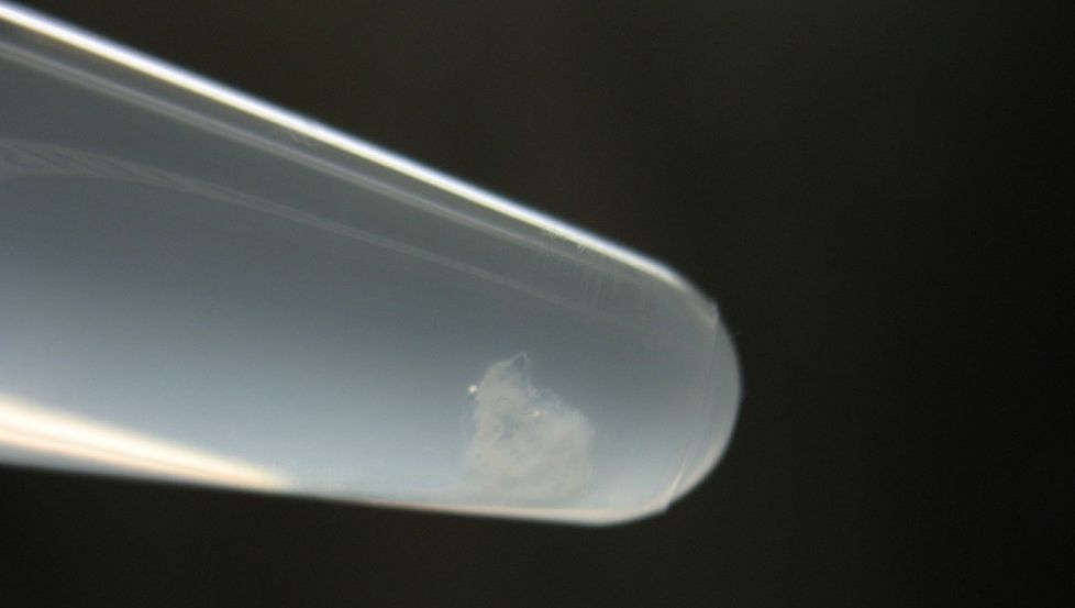 Nærbilete av reagensrøyr med synleg kveil av kvit tråd. Foto.