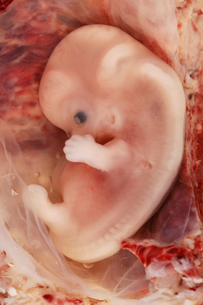 Menneskeembryo. Foto.