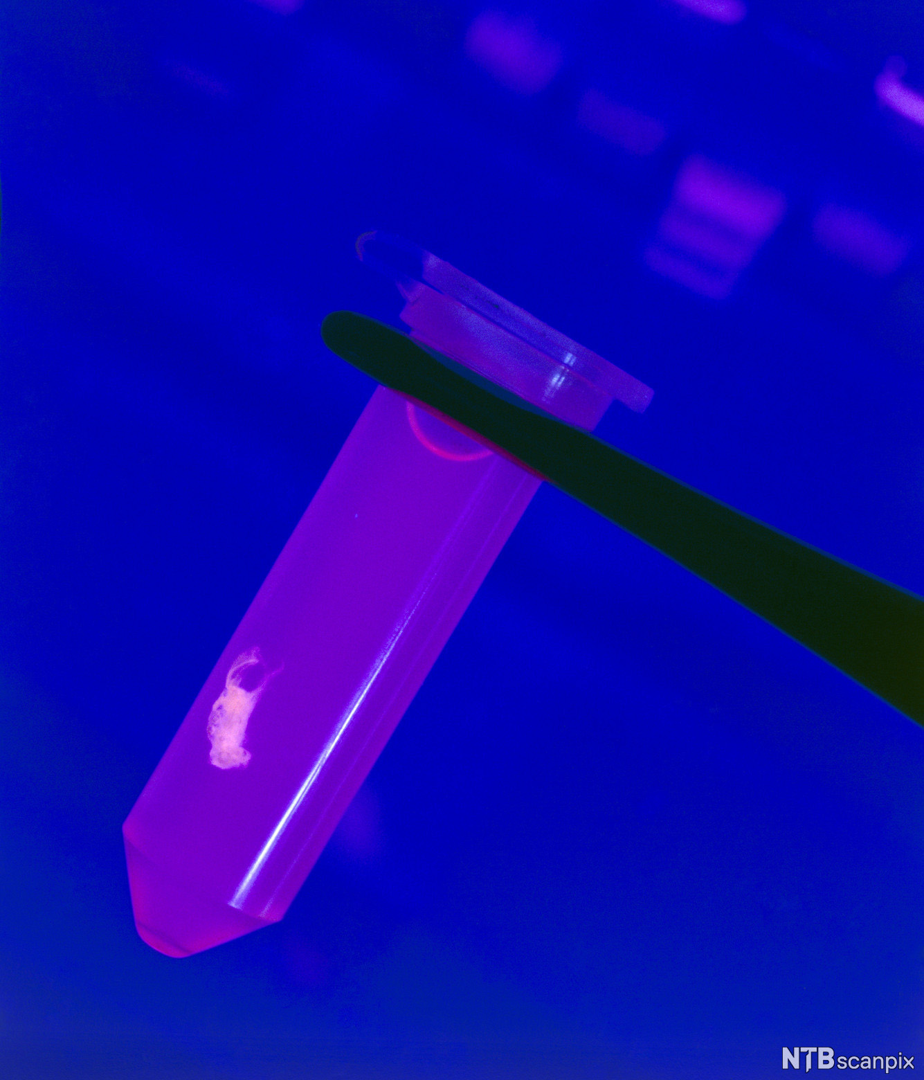 DNA klumpet seg sammen i en liten pellet. Foto.