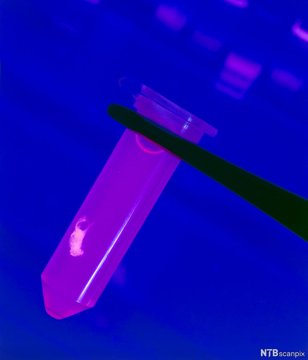 DNA som klumper seg sammen i en liten pellet inne i et eppendorfrør. Foto.