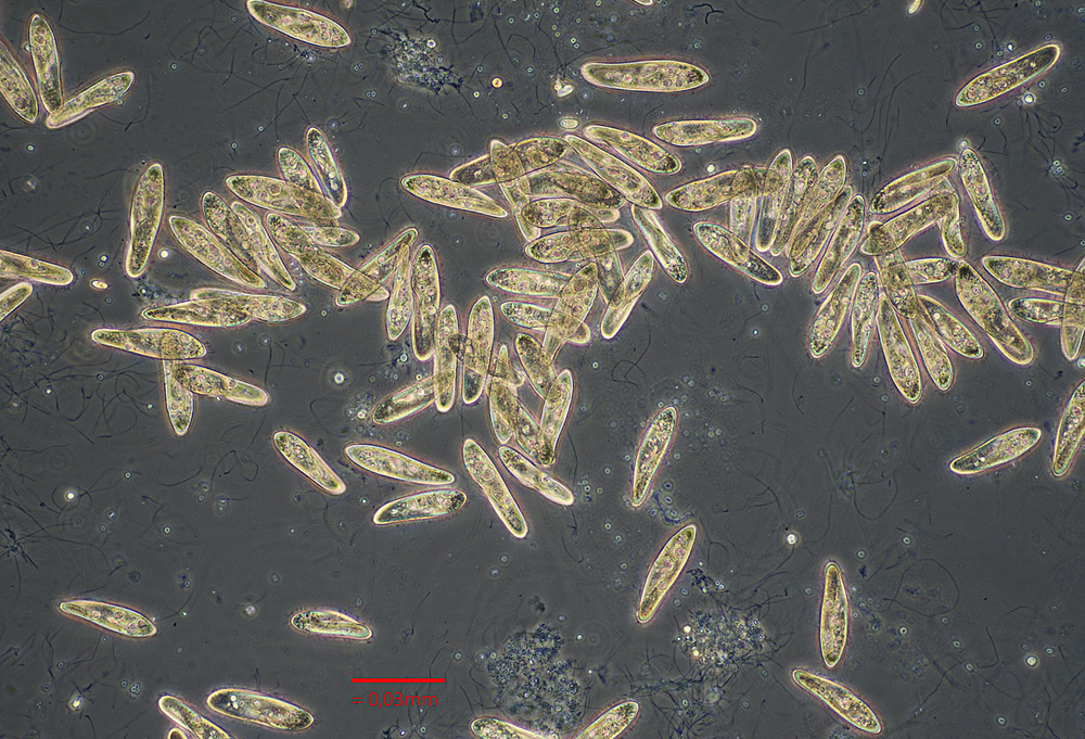 Mikroskopfoto av mange ovale organismer
