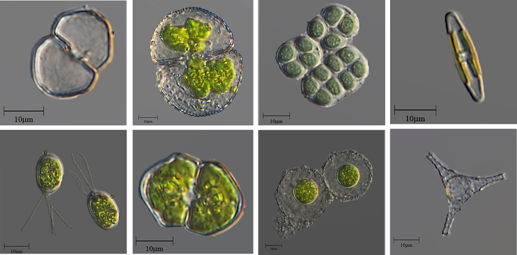 Kollasj av mikroalger. Mikroskopfoto. 