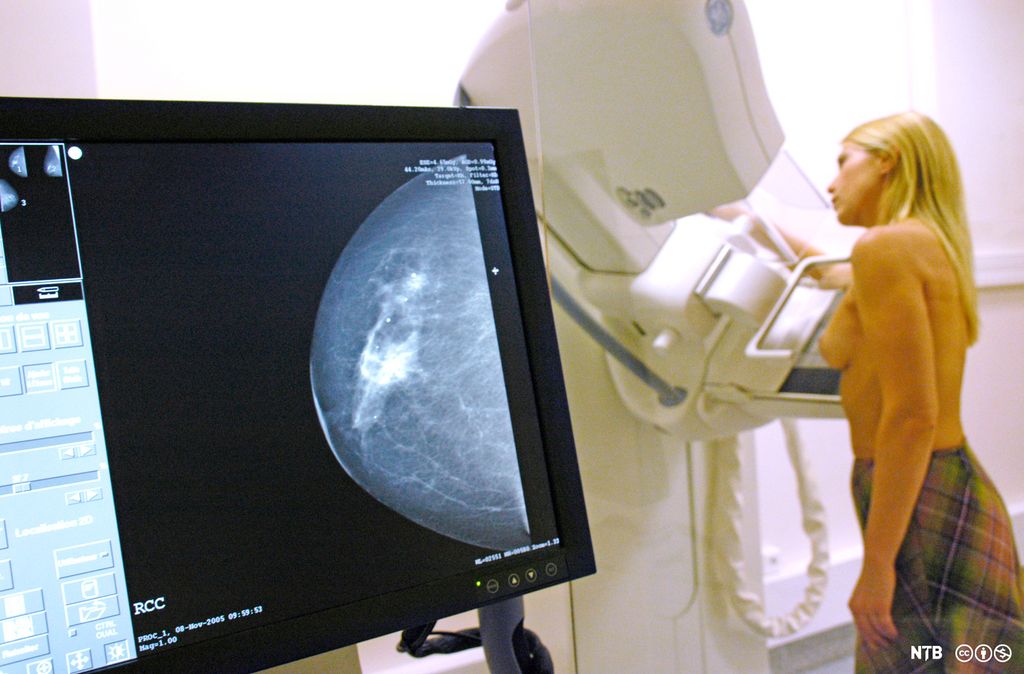 Røntgenbilde fra mammografiundersøkelse. Ung kvinne som undersøkes, i bakgrunnen. Foto.