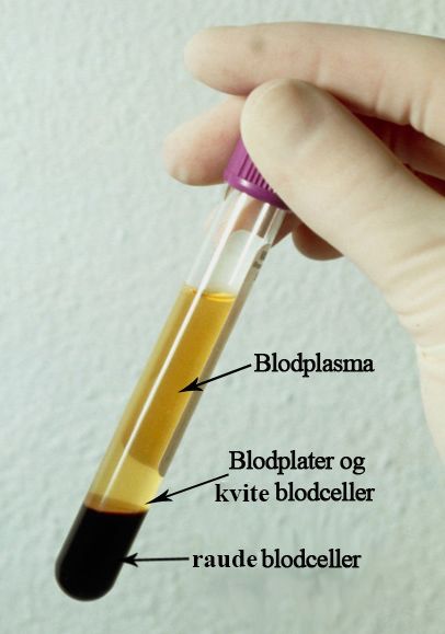 Sentrifugerør med innholdet delt i tre sjikt.