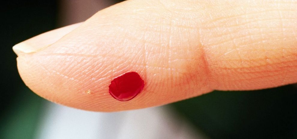 En finger med bloddråpe. Foto.