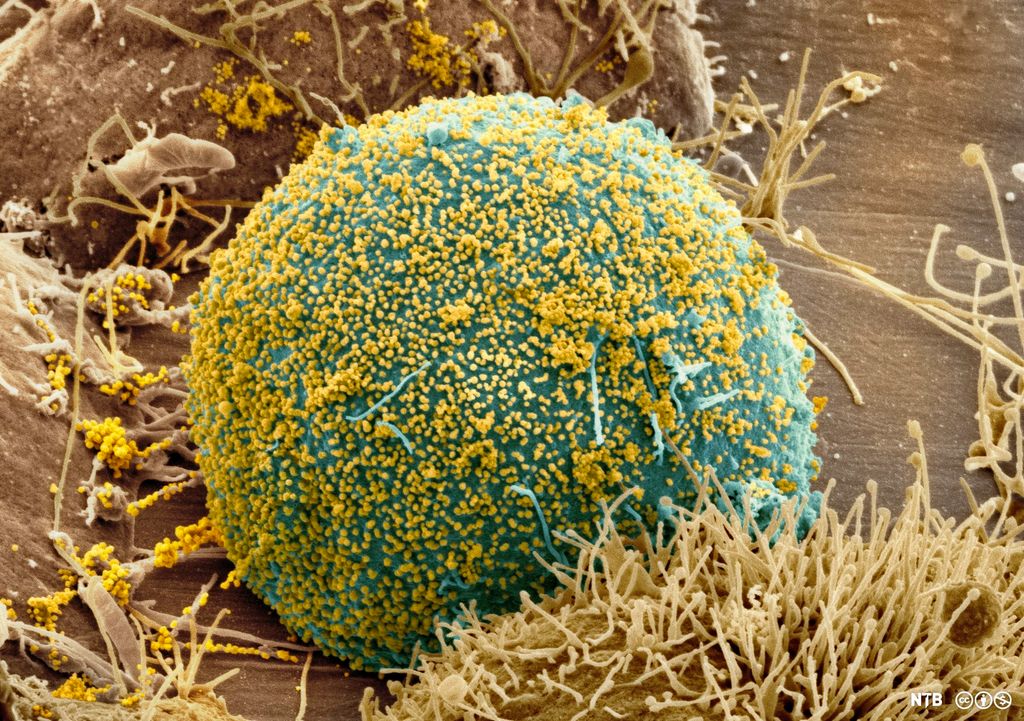 Ei stor, rund celle blir angripen av hundrevis av små virus som sit på celleoverflata. Mikroskopfoto. 