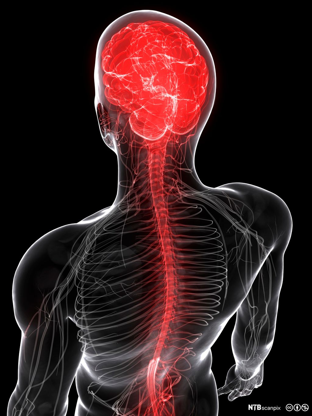 Illustrasjon som viser overkropp der hjerne og ryggmarg er markert