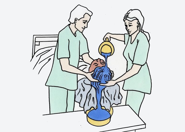 En mann og en kvinne vasker håret til en person som ligger i senga. Begge støtter personens hode mens kvinnen heller vann gjennom håret og ned i et vaskefat. Illustrasjon.