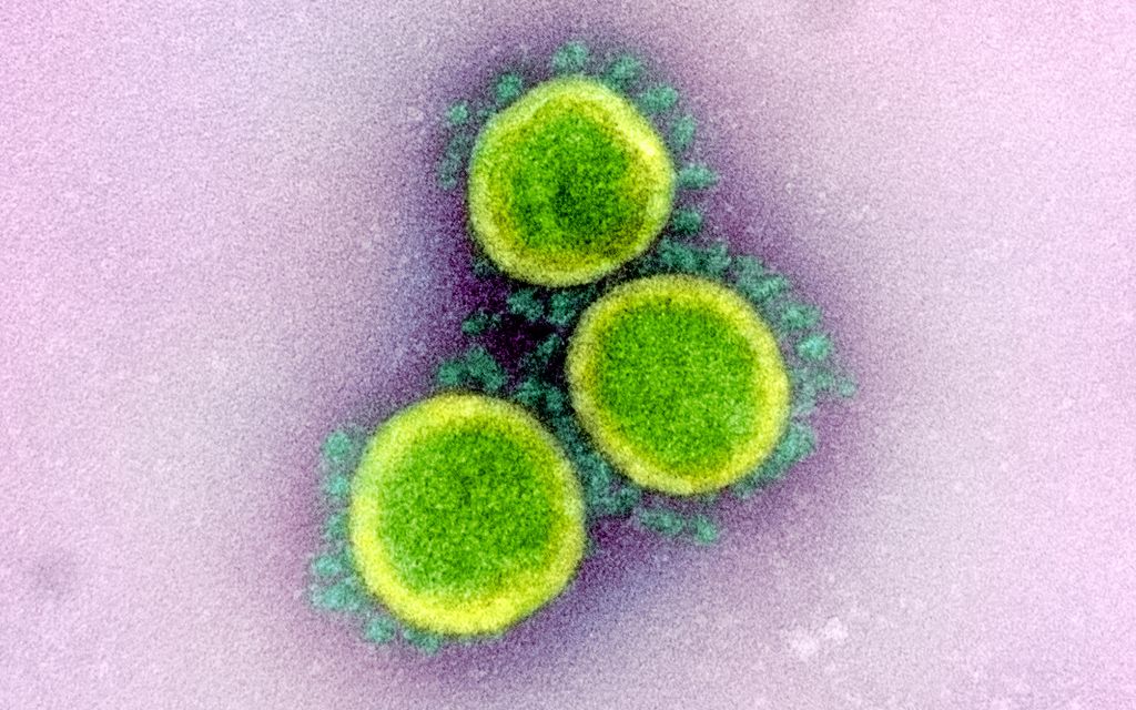 Tre kuler med pigger. Foto tatt gjennom elektronmikroskop.