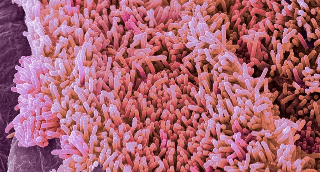 Farget elektronmikroskopbilde av E. coli-bakterien. Foto.