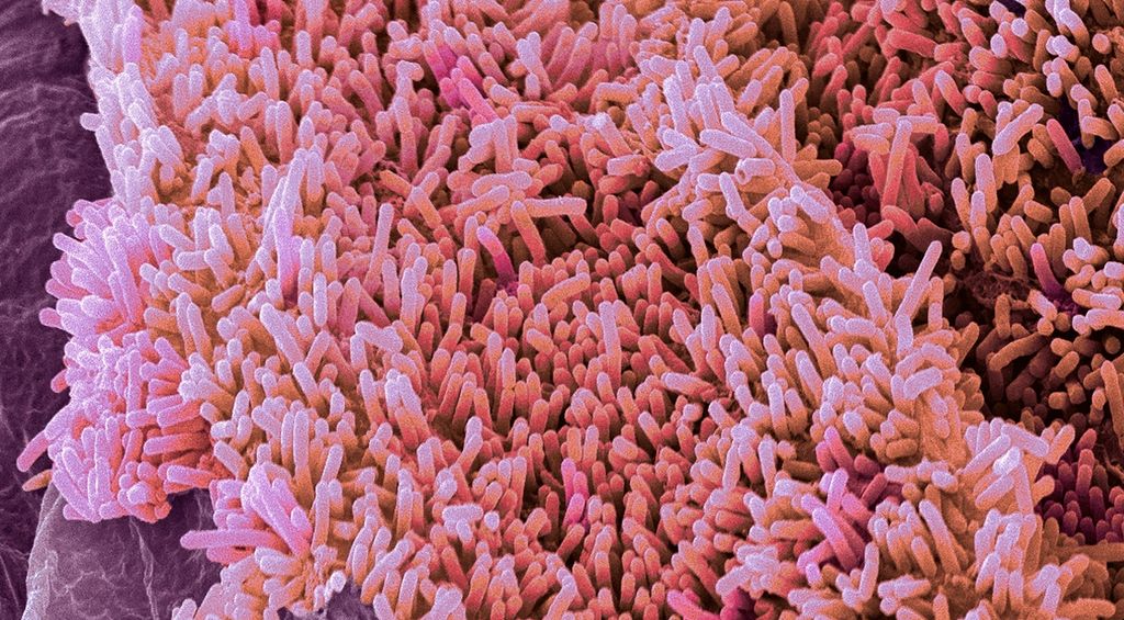 Farga elektronmikroskopbilete av E. coli-bakterien. Foto.