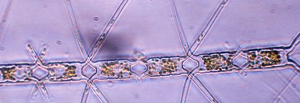 Mikroskopbilde av planteplankton. Foto.