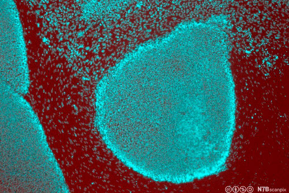 Asehis geardi olbmoseallain šaddá eallámušávdnasis. Govva. 