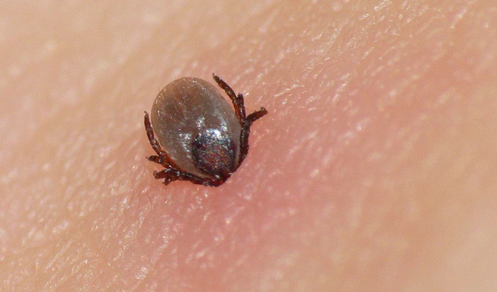Nærbilete av flått som har bite seg fast i huda på eit menneske. Foto.