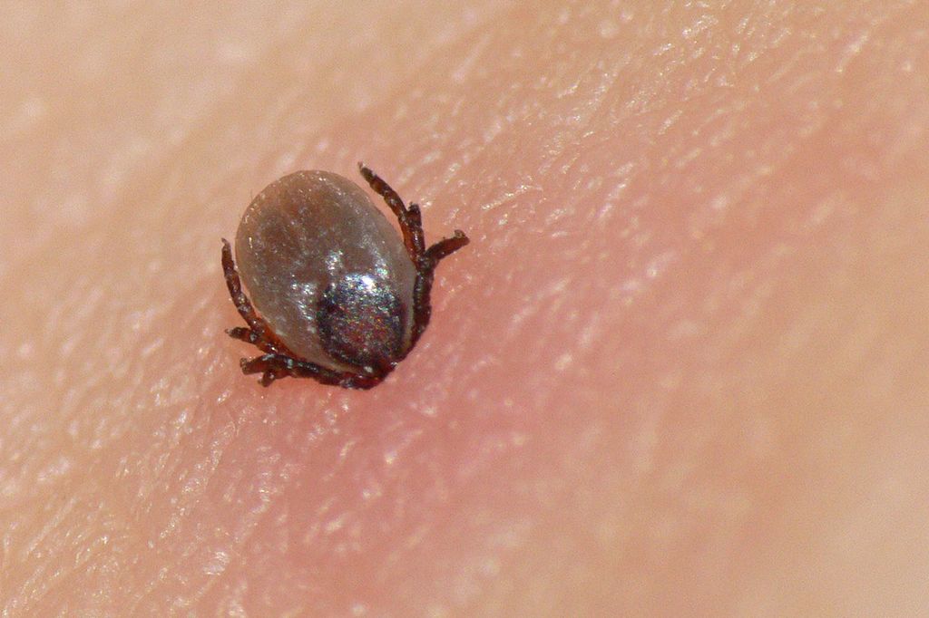Nærbilde av flått som har bitt seg fast i huden på et menneske. Foto.