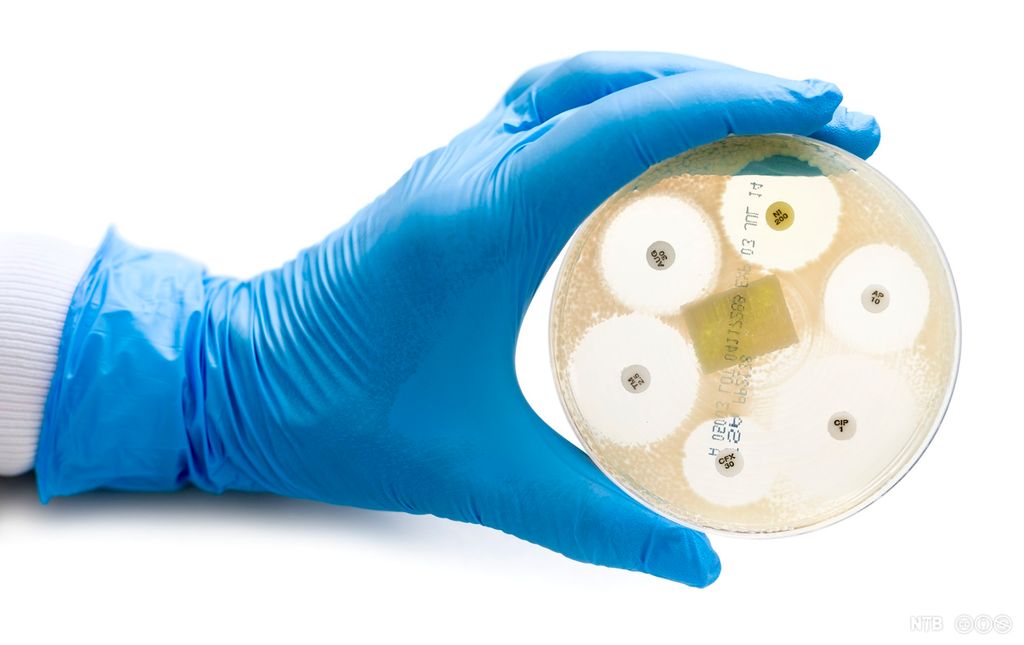Ei hånd med hanske viser fram ei petriskål med bakterier dyrket sammen med antibiotikatabletter. Det er en tydelig ring uten bakterievekst rundt hver antibiotikatablett. Foto. 