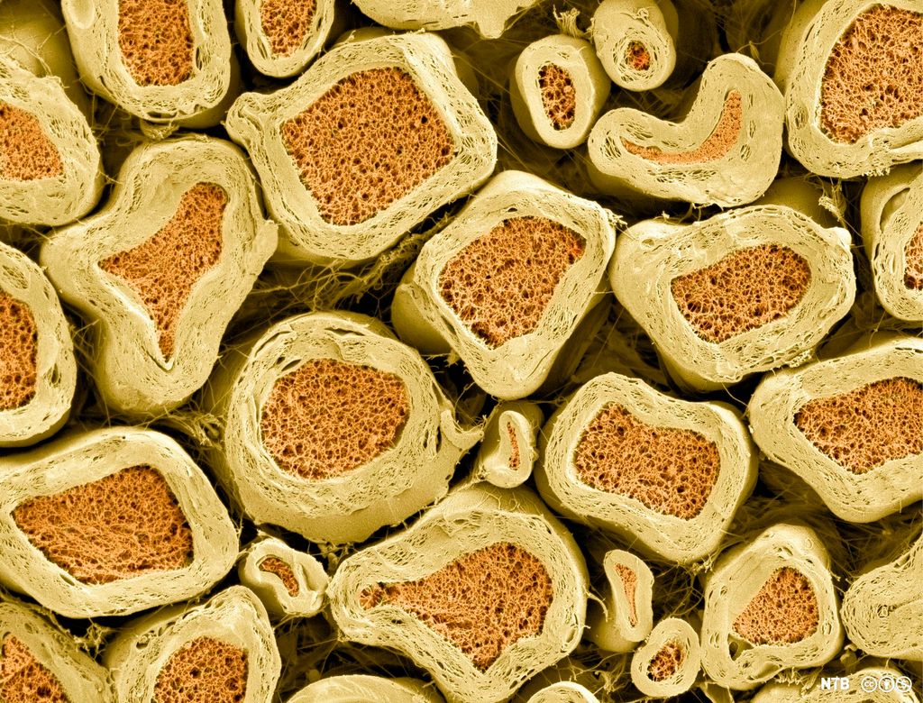 Mikroskopfoto der mange nervefibre (aksoner) i en nerve er skåret over. Vi ser alle aksonene som en mørkere kjerne omgitt av et lag med myelin. 