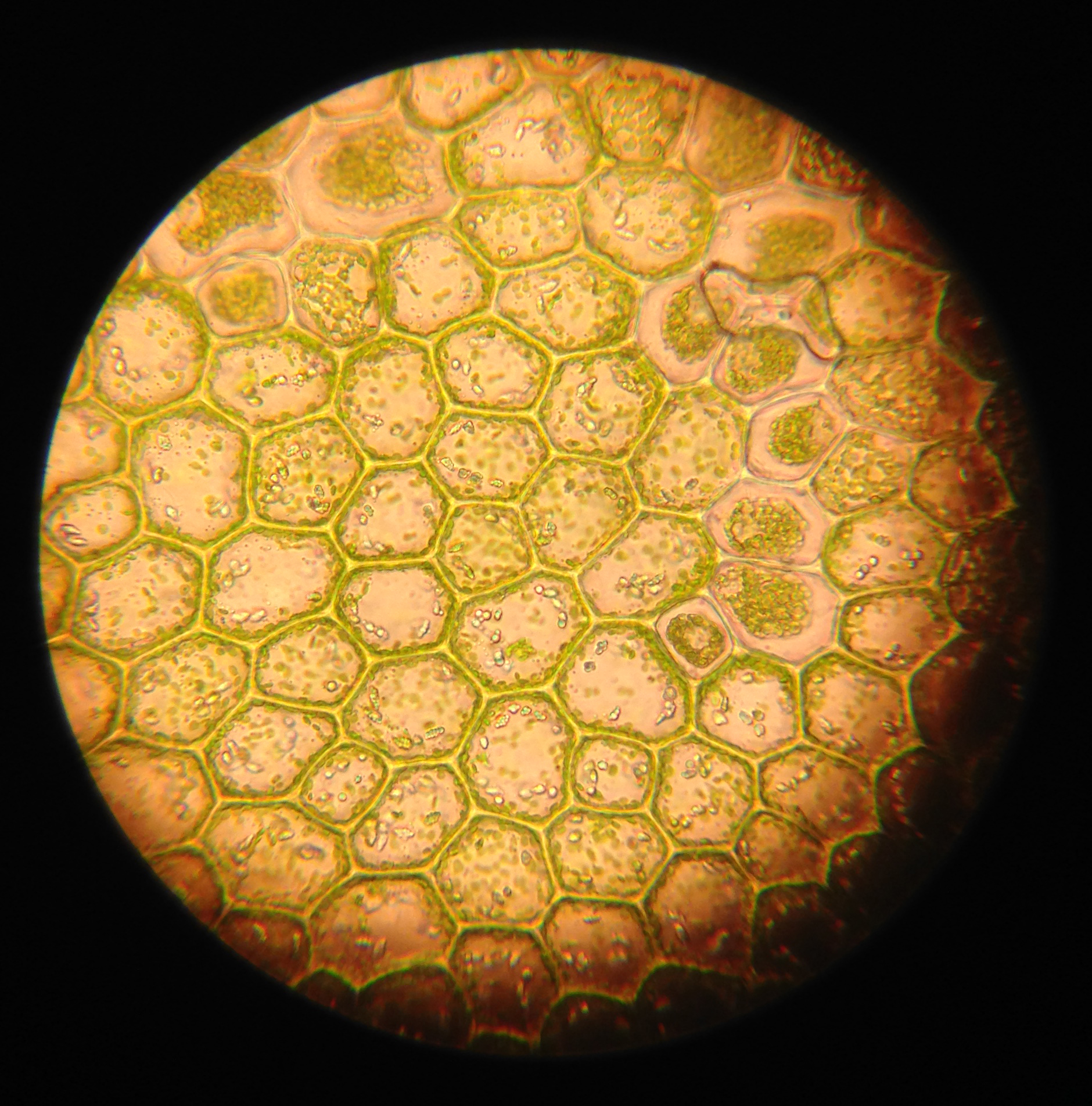 Mikroskopbilde som viser cellevegger og kloroplaster i en mosecelle. Foto.