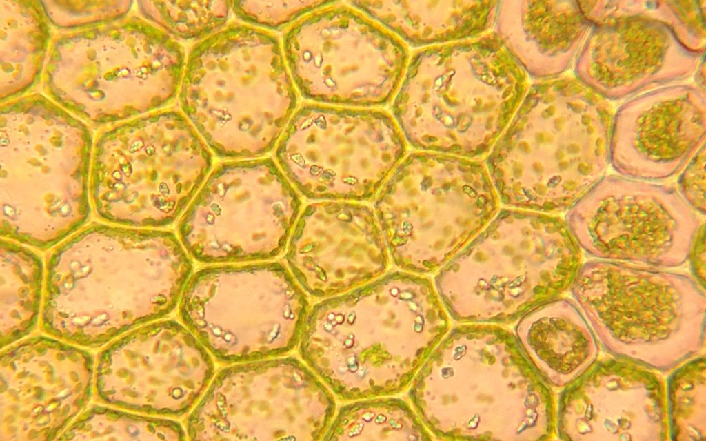 Mikroskopbilde som viser cellevegger og kloroplaster i en mosecelle. Foto.