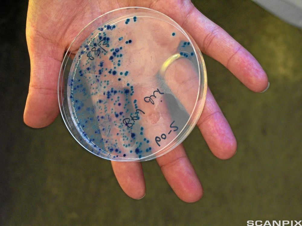 Ei låg, rund skål med ei mengde svarte prikkar på botnen av skåla. Foto.