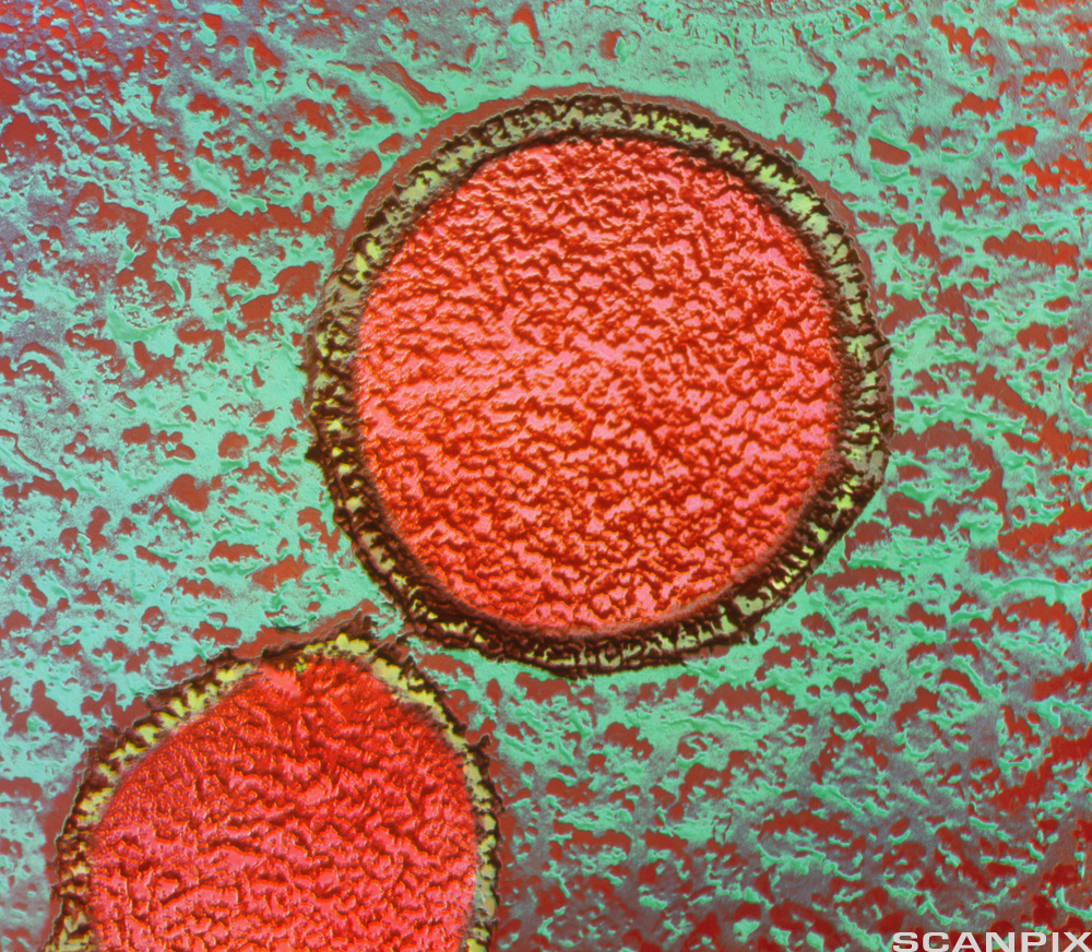 To runde bakterier. Bildet er tatt gjennom et elektronmikroskop. Foto.