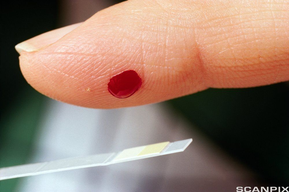 Finger med bloddråpe holdes over liten glassplate. Foto.