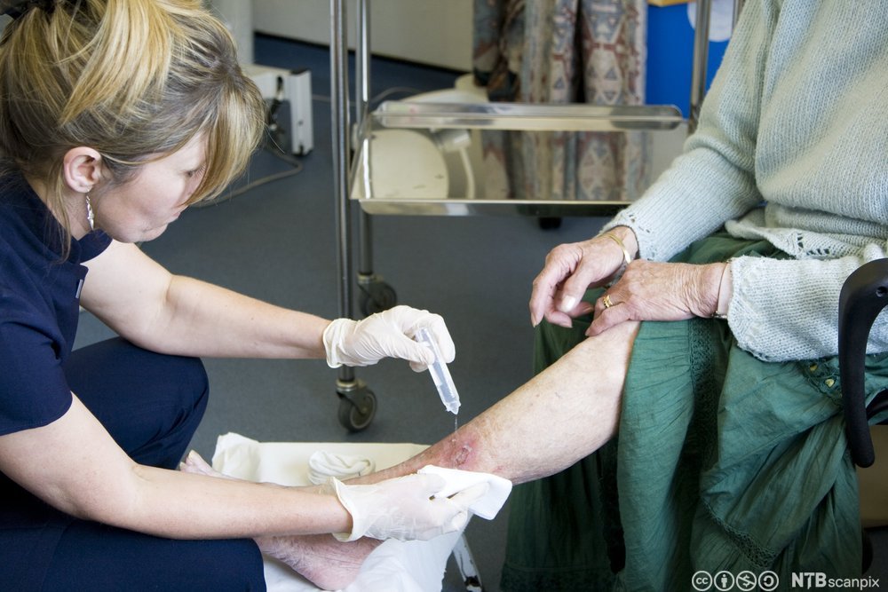 Helsefagarbeider med engangshansker steller et leggsår på en eldre bruker. Foto.