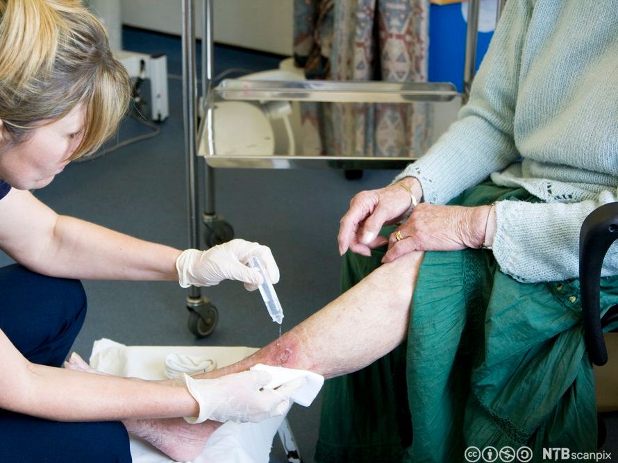 Helsefagarbeidar med eingongshanskar steller eit leggsår på ein eldre brukar. Foto.