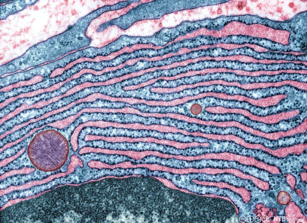 Mikroskopbilde av kanaler med små ribosomer på overflaten. Foto.