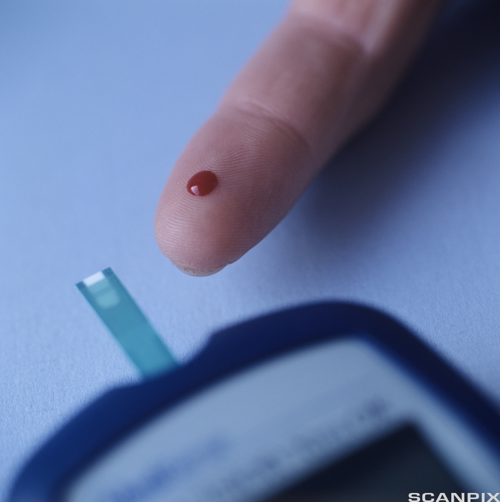 Måling av blodsukker, nærbilde av finger med en bloddråpe på. Foto.